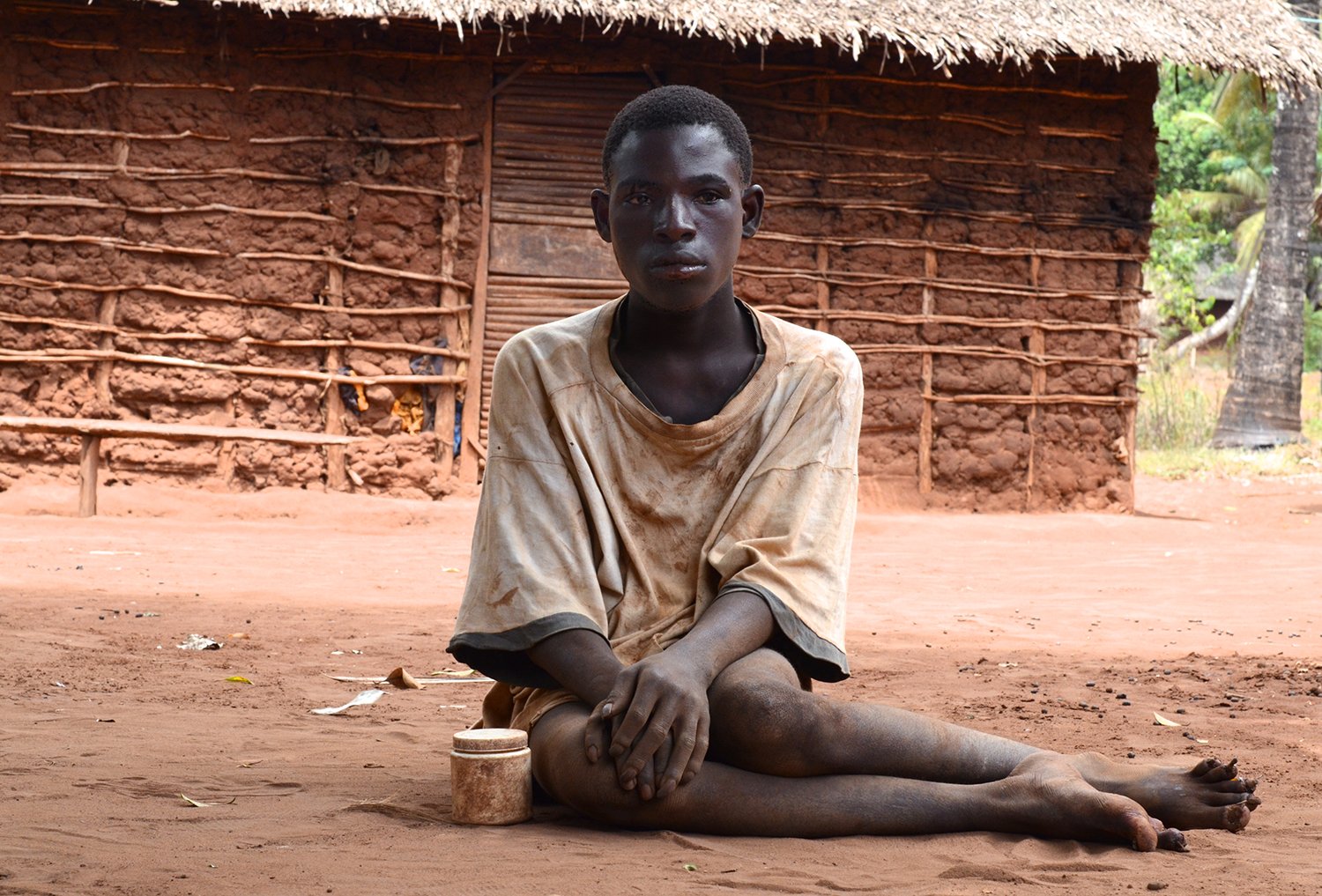 A young man is seated on the red earth outside a mud and mangrove pole house. His legs are folded awkwardly to one side.